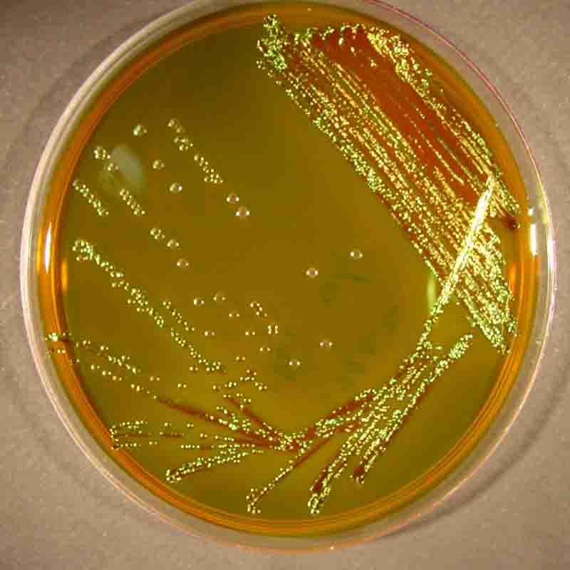 محیط کشت EMA Agar  	