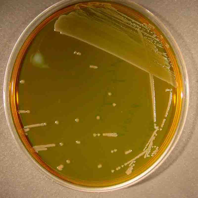محیط کشت EMA Agar  	